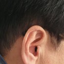 이상연보청기 이미지