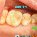자라진천 이미지