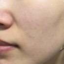 스와니코코 AC 컨트롤 딥 클렌저 후기 트러블 피부 진정 효과 솔직 리뷰