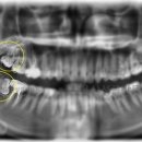 서울산성플란트치과의원 이미지