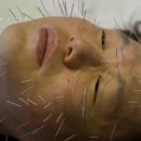 퍼스트한의원 이미지