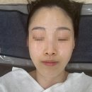 차뷰티 | 신림피부관리 디또뷰티 보라매점 3회차 후기! 얼굴라인 달라졌다는 말 듣는 이유