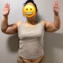 (주)시너빅 | 수원 빅사이즈 팔뚝지방추출 찐후기 3달만에 10kg 감량할 수 있던 비결은