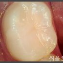 엘리트치과의원 이미지