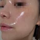 더포스트랩 | 피부과 재생크림 엘라스티 포스트랩 내돈내산｜피부과 추천템 사용 후기