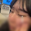 좋은의사들안과병원 | [공지] 울산 좋은의사들안과병원 라식/라섹 정밀검사 준비물, 비용 및 후기, 검사 소요시간, 검사전...