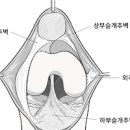 추벽증후군 원인 수술 예방 이미지