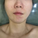 동탄 목동 윤곽관리 잘하는 곳 온새미로 뷰티토탈케어샵