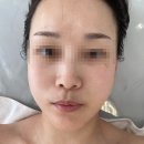 블랑드뷰티 | 화성남양피부관리 : 블랑드보떼에서 채움실 수분관리 후기