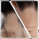 정희헤어라인 이미지