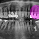 송탄바른치과의원 이미지