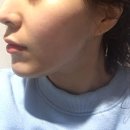 동안 피부 솔루션 이미지