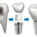 하나플란트치과의원 이미지