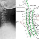 Re:저기 c-spine 쵤영법중에 filar 법이라는 촬영법이있나요? 이미지