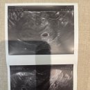 운정보건소 | 임신 확인후 해야 할 것 | 운정보건소 임산부 등록 +임신초기 검사 후기