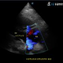 함께하는 동물병원 | 경산동물병원 강아지심장병으로 복수가 차요.