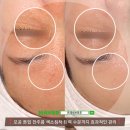 프레쉬브로우