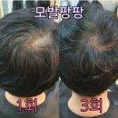 큐사랑(Q사랑) 네이버블로그