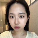 [수원피부관리] 약손명가 작은 얼굴 관리 후기
