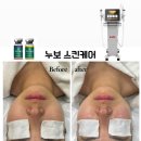 누보스킨케어 이미지