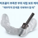 프레임치과기공소 이미지