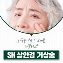 이상호성형외과 또렷하고 시원한 눈매를