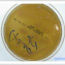 BAP&MAC(Pseudomonas aeruginosa)의 모습 이미지