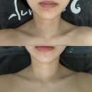 ㈜서초나눔장터 | W8. 강남 신부관리 맛집 가인미가에서 신부관리B 10회차 관리받은 찐 후기
