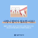 서울턱사랑니치과 이미지