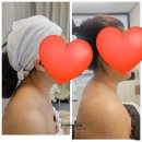 루밍에스떼 | 의정부 민락 2지구 피부관리 신부관리 승모근 거북목 등 관리