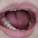 예쁜선치과교정과치과의원 | 구월동 스케일링 제대로 해주는곳 예쁜선치과 내돈내산