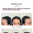 샵제이드헤어 | [경남두피문신] 제이드도트 여성 헤어라인 시술 후기
