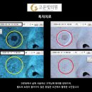 순천의원 티스토리