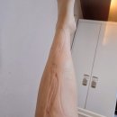 미래로21 | 출산후기 *미래로병원* 제왕절개 1인실 입원후기