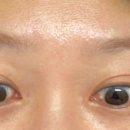 속편한드림내과의원 네이버블로그