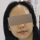 동탄피부관리 다올뷰티 동탄점 프리미엄케어 솔직후기