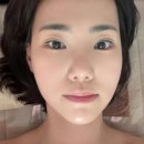 스타트메디칼 | 뷰티다룸 강남본점 여배우 윤곽관리 후기｜ 윤곽관리 승모근 웨딩관리 추천