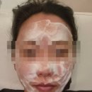 끌리메 | 수원 인계동 에스테틱 끌리메 후기! 두번째 방문 후기 끌링 얼굴관리