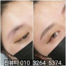 고은하늘성형외과의원 | 분당 여자눈썹전문 디자인 잘하는 곳 (+후기)