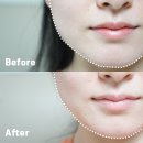 디바스킨클리닉 | 나주 혁신도시 피부 관리, 디바스킨클리닉 안 아픈 작은얼굴 관리 솔직 후기