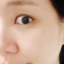 녹십자 | 강남피부과추천, 피부가 다시 태어나는 느낌의 녹십자 리본느 케어 후기