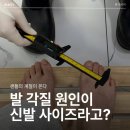 7348 | 레푸스 비용 얼마?｜발각질 제거 받으러 갔다가 진단까지 받은 후기