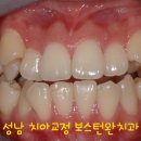 보스턴완치과의원 이미지