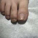 매료네일 문제성전문점 이미지