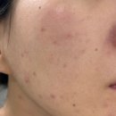 조금 | 탈리다쿰 화이트 단델리온 에센스 수 한 달 조금 넘은 후기