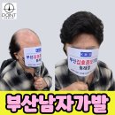 좋은가발스타일 | 부산남자가발 후기 자연스러운 스타일 찾는 방법 정리