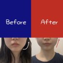 부천 피부관리 작은얼굴 관리 결이고은 부천상동점 비스포크 A관리 추천 솔직후기