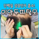 이안두피탈모 이미지