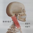 중풍의 자연의학 이미지