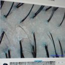 웰킨두피탈모센터시흥배곧 | [경기/시흥] 웰킨두피탈모센터 시흥배곧점 후기_배곧두피관리